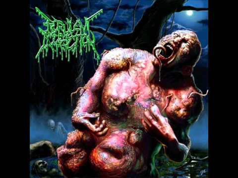 Purulent Infection - Exhuming the Putrescent