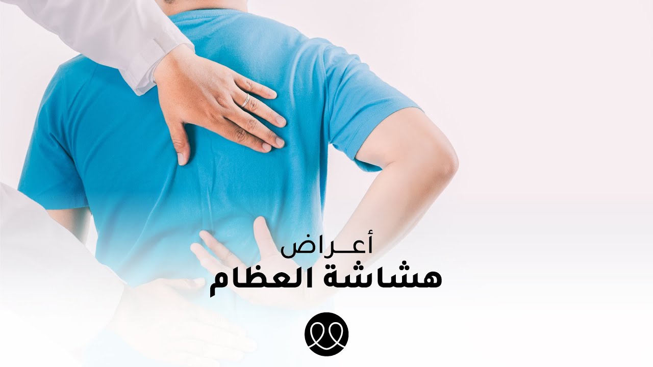 أعراض هشاشة العظام