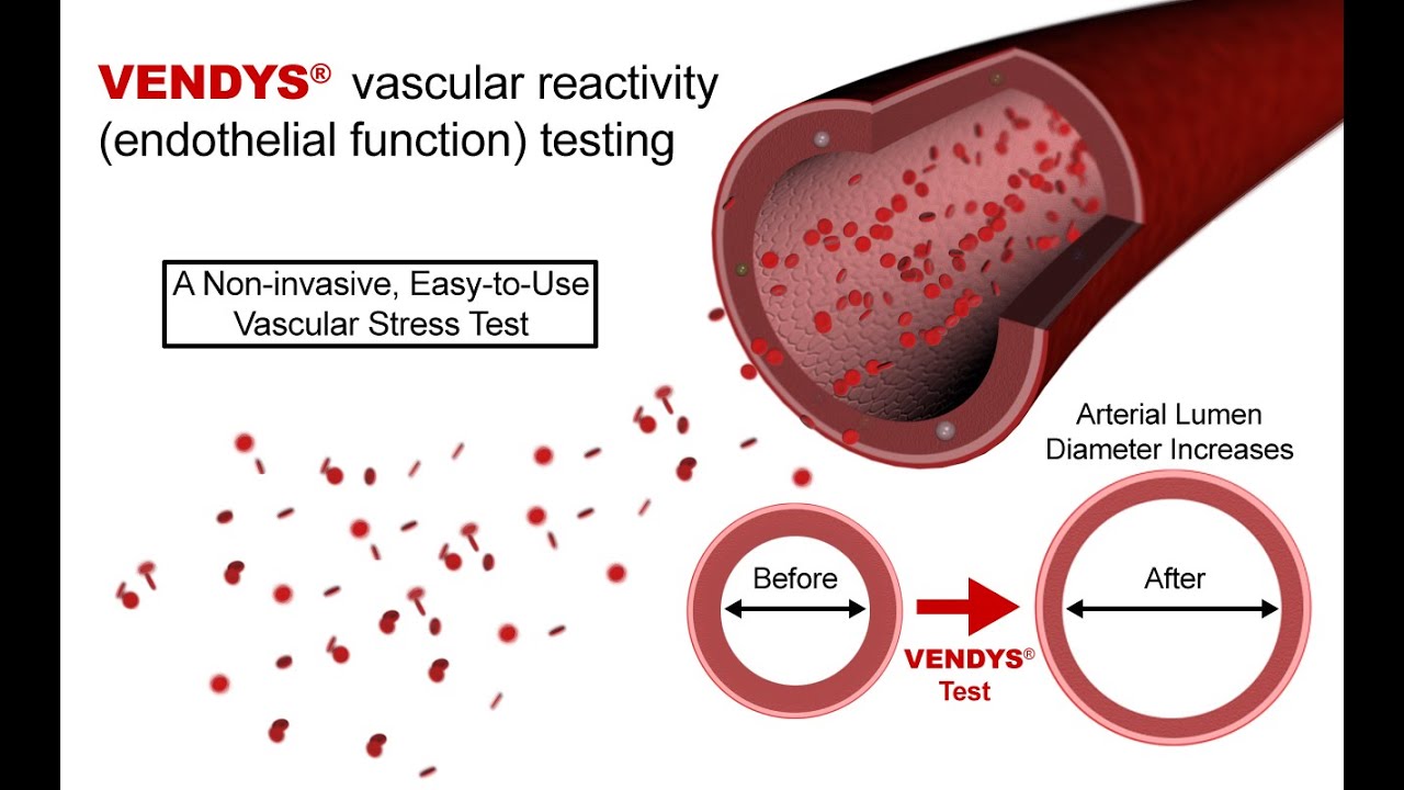 VENDYS -- Endothelial Function Measurement Explained - YouTube