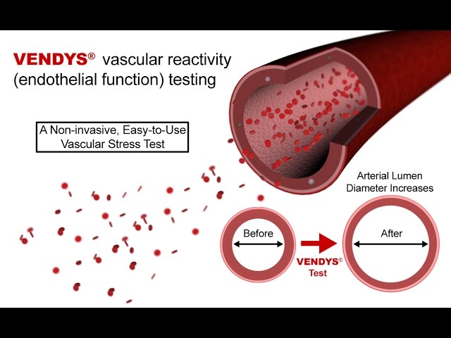 Video Pronunciation of endothelial dysfunction in English Video Pronunciation of endothelial dysfunction in English
