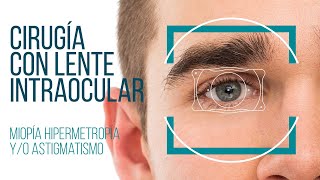 Cirugía con lente intraocular para la mejora de la miopia, hipermetropía y/o el astigmatismo
