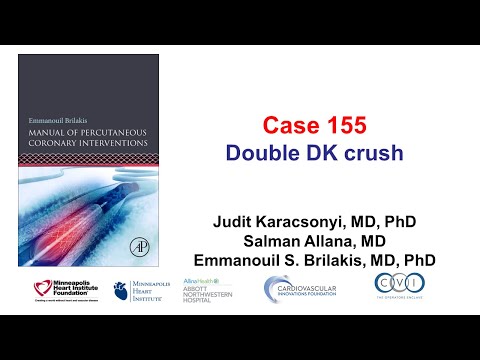 Case 155: Manual of PCI - Double DK crush