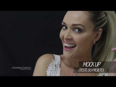 Dr Gustavo Caetano - Depoimento Fernanda Schonardie