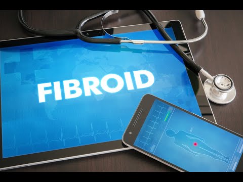 Fibroids Miracle Trick - mark kelley on miracle mineral solution (mms) - the fifth estate