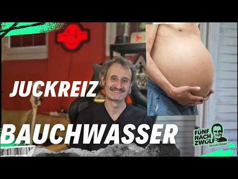 Bauchwasser und Juckreiz Ursachen und Tipps bei Leberzirrhose !