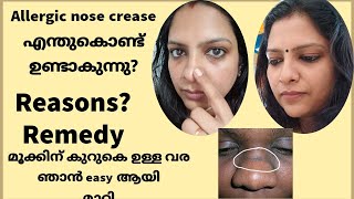 Allergic Nose Crease|How to get rid of DARK LINE on NOSE |മൂക്കിന്  കുറുകെയുള്ള വര എങ്ങനെ മാറ്റാം