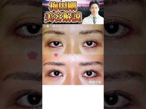 医学科 30代の眼瞼下垂