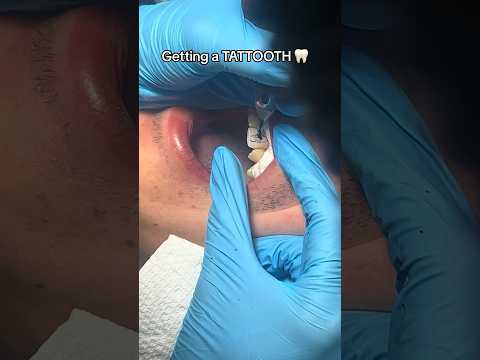 Can You Really Tattoo Your TEETH?! 😳🦷