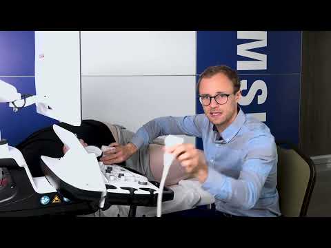 Ocena żył kończyn dolnych - dr n .med. Michał Podgórski