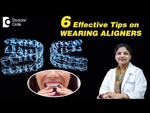 6 Easy Tips to make Invisible Aligners work Faster  - Dr. Divyashree Rajendra | Doctors' Circle