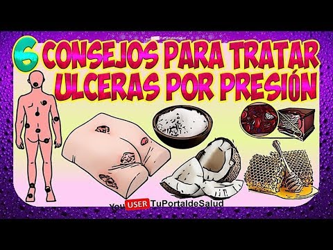 6 Tips for Treating Pressure Ulcers | Bedsores and Sores Remedies