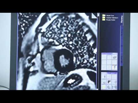 Emangioma del rachide cervicale Legamento lacerato spalla che curare