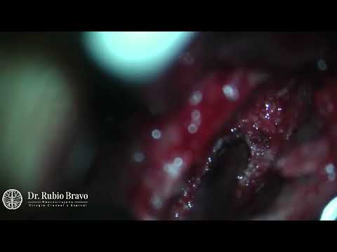 Jose  Rubio Bravo-7