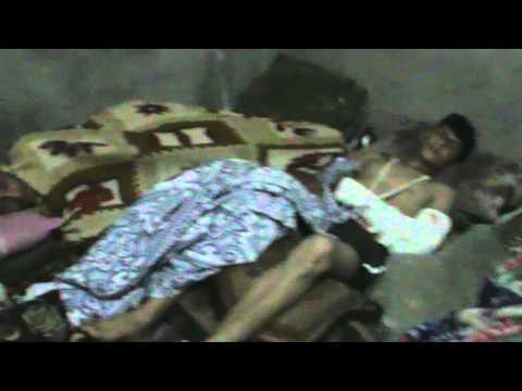 جرحى عناصر كتيبة الشهيد ضياء جمول أثناء التصدي لقوات النظام في القصير في ريف حمص