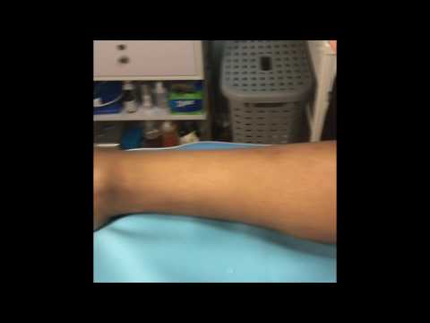 Leg Sugaring : body Sugaring