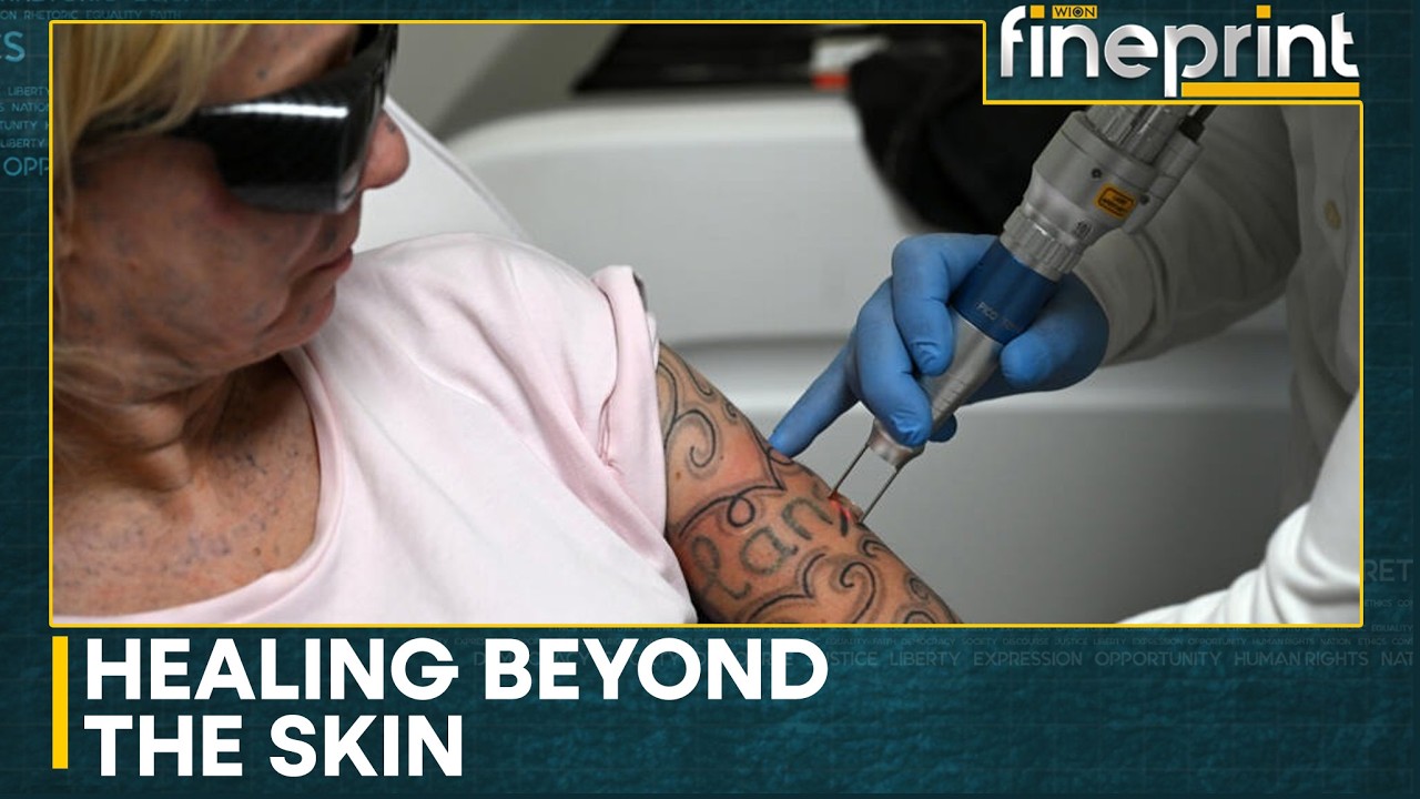 Rotterdam-Based Foundation Helps Women Erase Forced Tattoos | WION Fineprint