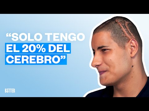 “I have survived 50 operations and two deaths at just 18 years old” | Roque Star