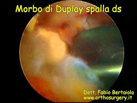 Se vè mancanza di respiro in osteocondrosi del toracica Emartro delle fasce per le ginocchia