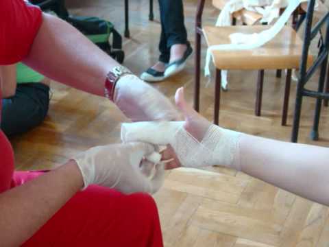 Koślawe stopy w sprawy dzieci Valgus wg ICD-10