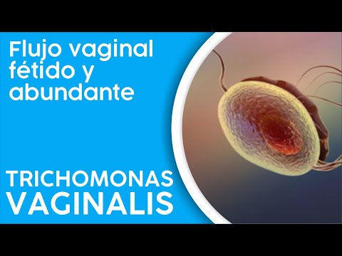 Kezeli a Trichomonas-t, Trichomonas Vaginalis téma