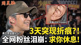 周星驰耳朵惊现“神秘折痕”？医学上叫弗兰克征！粉丝齐哭喊：求你别拼了！