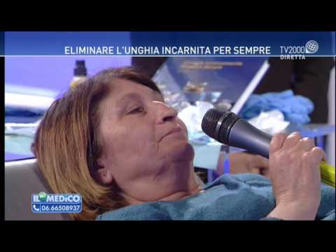 A eczema che può esser mangiato La dermatite di atopic versa una fotografia a