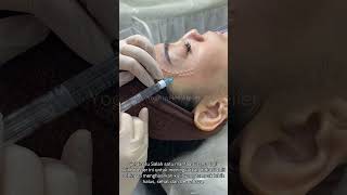 Download lagu Kulit Glowing ala Seleb Korea dengan Skinbooster Rejuran Salmon DNA! 🐟✨ mp3 Download lagu Kulit Glowing ala Seleb Korea dengan Skinbooster Rejuran Salmon DNA! 🐟✨ mp3