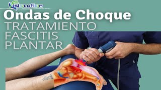 ONDAS DE CHOQUE - TRATAMIENTO FASCITIS PLANTAR con ESPOLON CALCANEO Fisioterapia | Fisiolution