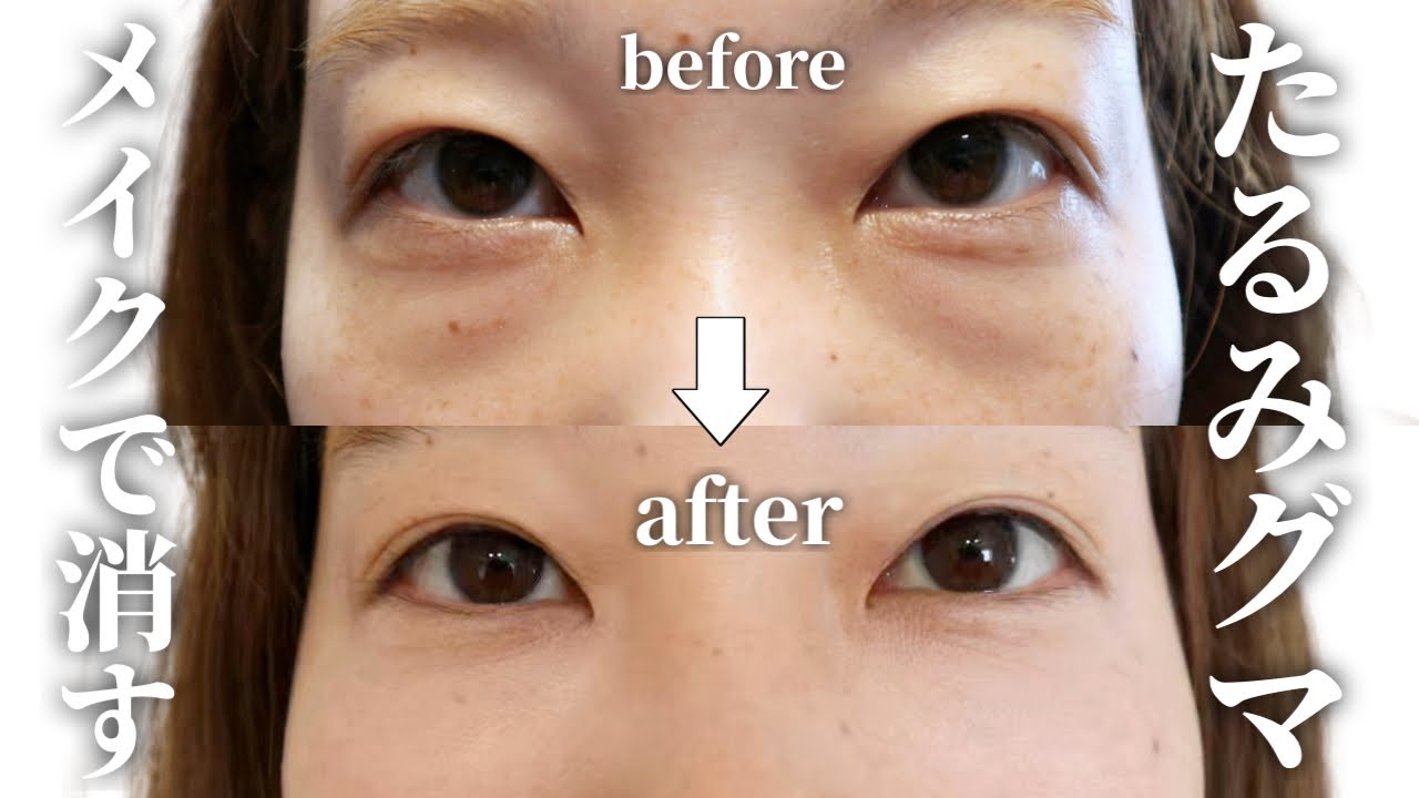 【30代必見】たるみグマを自然に消して-5歳若見えするコンシーラー術。厚塗り感なし✨