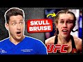 Doctor Reacts To Painful UFC MMA Injuries