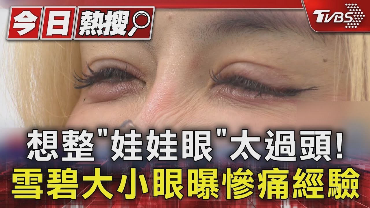 獨/想整「娃娃眼」太過頭!雪碧現身認無法闔眼...慘況全曝光
