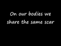 Razorlight - Wire to Wire with Lyrics [HD]