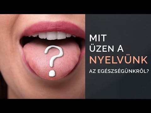 , title : 'Mit üzen a Nyelvünk az egészségünkről?'