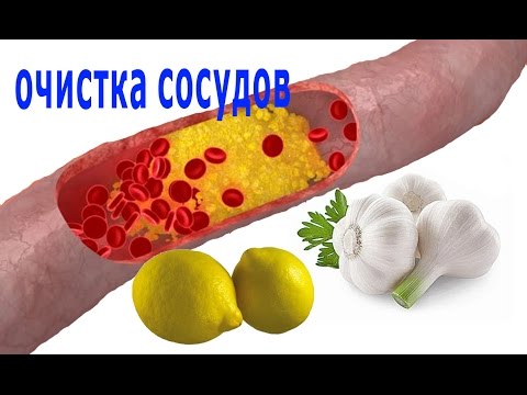 Meteorizm da parassiti Il fungo un mukor appartiene a funghi a parassiti