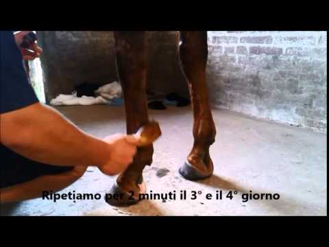T endoprotesi chirurgia dellanca Metodi tradizionali anca coxartrosi 2 gradi di trattamento