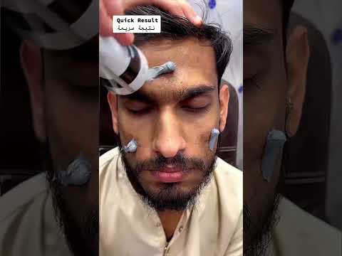 Glow & Clean Activated charcoal Face Wash #youtubeshorts