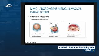 Mielomeningocele: comissão vai pedir cirurgia intrauterina no SUS