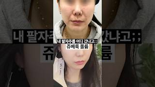 팔자주름 다림질한 후기😖