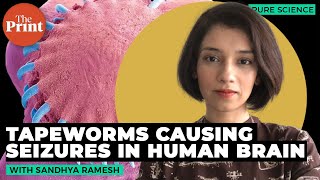 What is neurocysticercosis — seizures caused by tapeworm cysts in human brain