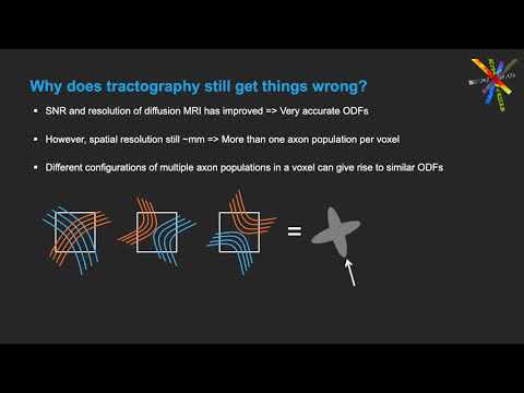 Towards taking the guesswork and (and the errors) out of diffusion tractography (Abstract 856)