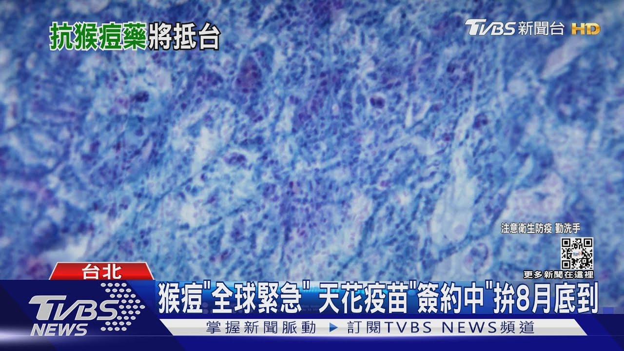 猴痘「全球緊急」 天花疫苗「簽約中」拚8月底到