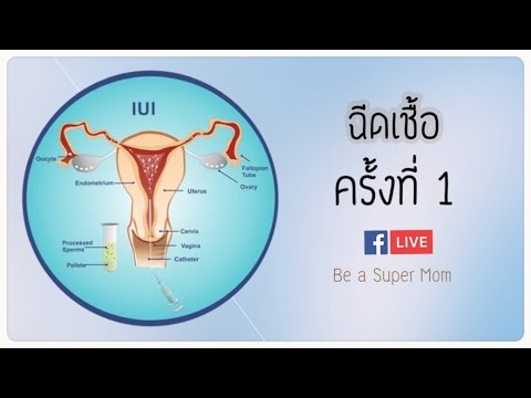 จามรีเพิ่มบ้านสมาชิก Lozap และความอ่อนแอ