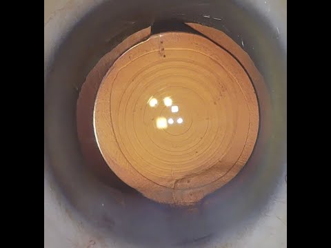 Cataract Surgery with Multifocal IOL