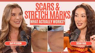 What Really Works for Scars & Stretch Marks? Esthetician Amy Peterson Breaks It Down | GlowLab