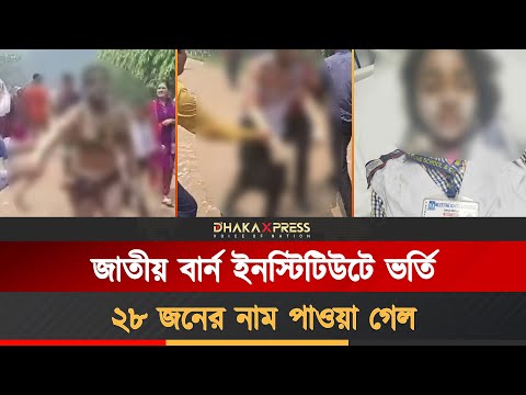 বার্ন ইউনিটে ভর্তি ১২০ জন