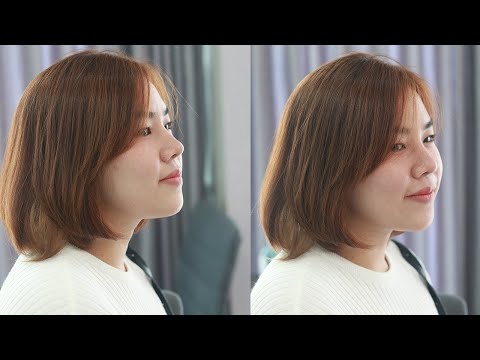 จมูกสโลปสวยเข้ากับใบหน้า ทรง Slope Barbie”  เสริมจมูก ซิลิโคนพรีเมียม USA ที่ #NaradaExpertClinic  จมูกสโลปสวยเข้ากับใบหน้า ทรง Slope Barbie”  เสริมจมูก ซิลิโคนพรีเมียม USA ที่ #NaradaExpertClinic