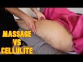 Tiefengewebsmassage Zur Beseitigung Von Cellulite An Den Beinen
