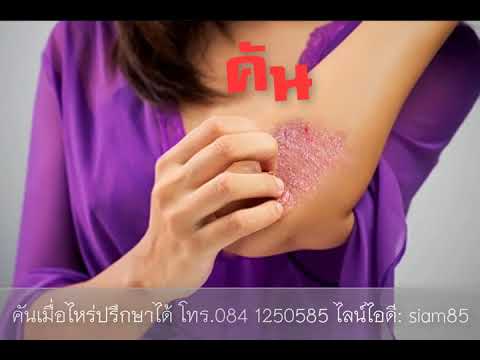 ผลิตภัณฑ์สำหรับกาแฟโรคสะเก็ดเงิน อาหาร hypoallergenic กลาก
