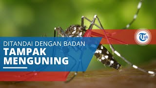 Demam Kuning, Disebabkan oleh Virus Genus Flavivirus dan Disebarkan oleh Nyamuk Aedes Aegypti