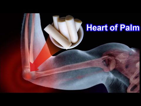YouTube video about: Can dogs have hearts of palm?
